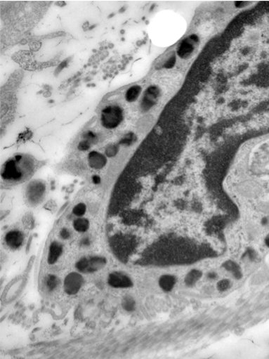 Imagine de microscopie electronică a biopsiei cutanate, după tratament.